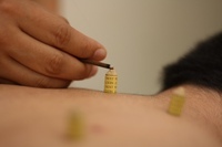 白山はりきゅう整骨院のプレスリリース画像6