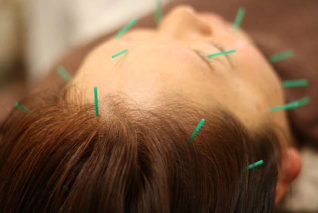 白山はりきゅう整骨院のプレスリリース画像4