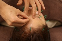 白山はりきゅう整骨院のプレスリリース画像2