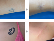 ガーデンクリニックのプレスリリース画像1