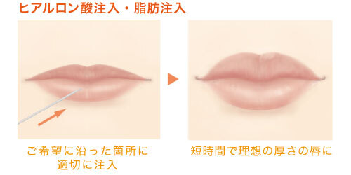 ガーデンクリニックのプレスリリース画像3