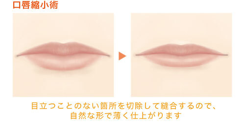 ガーデンクリニックのプレスリリース画像2