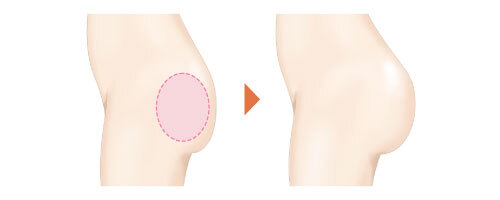 ガーデンクリニックのプレスリリース画像2