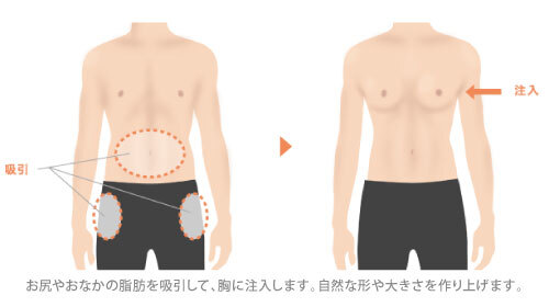 ガーデンクリニックのプレスリリース画像3