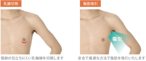 ガーデンクリニックのプレスリリース画像3