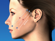 ガーデンクリニックのプレスリリース画像2