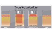ガーデンクリニックのプレスリリース画像2