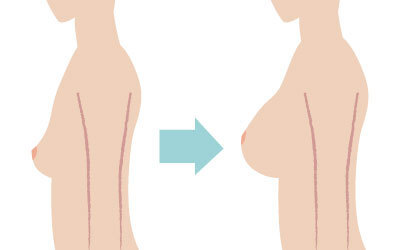 ガーデンクリニックのプレスリリース画像2