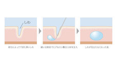 ガーデンクリニックのプレスリリース画像2
