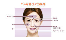 ガーデンクリニックのプレスリリース画像3