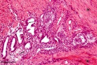 株式会社セルペップのプレスリリース