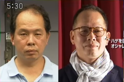 モテハゲアカデミーのプレスリリース画像1