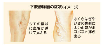 東京血管外科クリニックのプレスリリース画像4