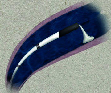 東京血管外科クリニックのプレスリリース画像5