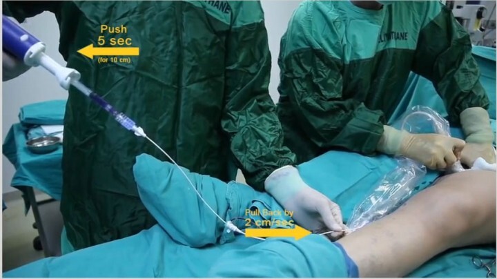 東京血管外科クリニックのプレスリリース画像1