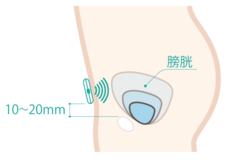 ＤＦｒｅｅ株式会社のプレスリリース画像3