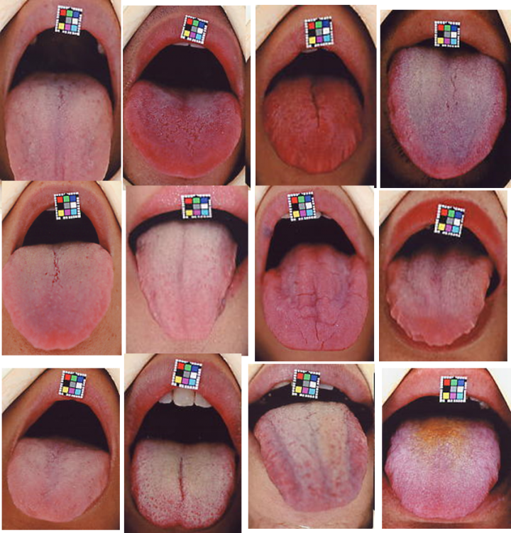 中城歯科医院のプレスリリース画像5