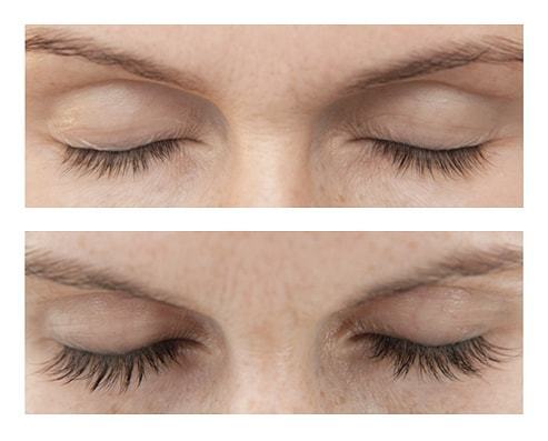 APRIS GmbHのプレスリリース画像4