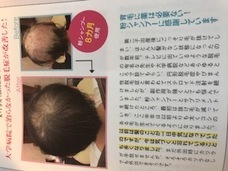 株式会社　T-CUBE　(ヘッドスパ専門店プーラ)のプレスリリース画像6