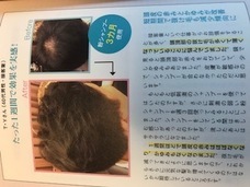 株式会社　T-CUBE　(ヘッドスパ専門店プーラ)のプレスリリース画像5