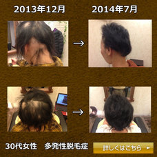 株式会社　T-CUBE　(ヘッドスパ専門店プーラ)のプレスリリース画像2