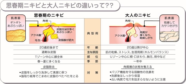 思春期ニキビ と 大人ニキビ の違いを8割以上が知らない 親と子世代での思春期ニキビの意識の差も ニキビつぶす派 親世代4割 子世代1割 ロート製薬株式会社 のプレスリリース 思春期ニキビ と 大人ニキビ の違いを8割以上が知らない 親と子世代での思春期ニキビの意識の差も ニキビつぶす派 親世代4割 子世代1割 ロート製薬株式会社 のプレスリリース