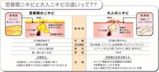 ロート製薬株式会社 のプレスリリース画像2