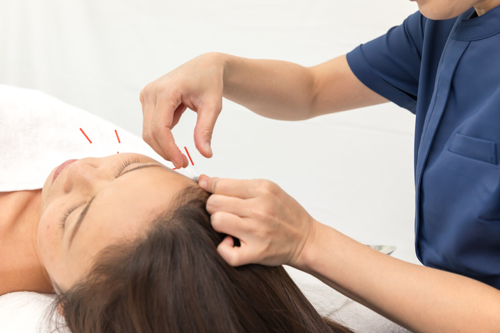 はり小町のプレスリリース画像3