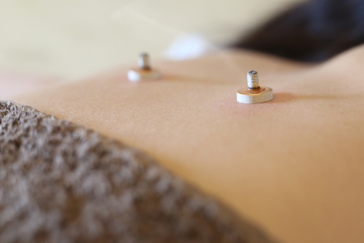 はり小町のプレスリリース画像3