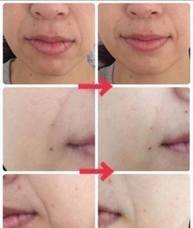 エステルームSalon de Blancのプレスリリース画像4