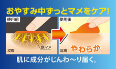 株式会社サイプラスのプレスリリース画像4