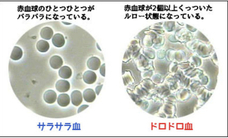 汗活Labo　Asterのプレスリリース画像1