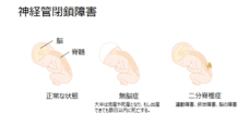 慶應義塾大学 SFC 健康情報コンソーシアムのプレスリリース画像2
