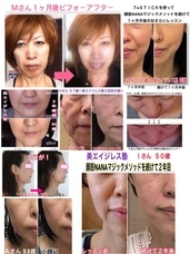 美エイジレス塾のプレスリリース画像6