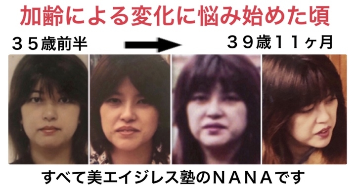 アフターコロナに美しくスタートする 美容外科で 切らないとダメ と言われた 顔のたるみ を自力で改善したセルフメソッドが凄い 美エイジレス塾のプレスリリース アフターコロナに美しくスタートする 美容外科で 切らないとダメ と言われた 顔のたるみ を自力で改善したセルフメソッドが凄い 美エイジレス塾のプレスリリース
