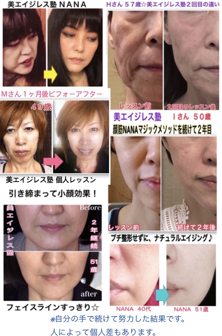 アフターコロナに美しくスタートする 美容外科で 切らないとダメ と言われた 顔のたるみ を自力で改善したセルフメソッドが凄い 美エイジレス塾のプレスリリース アフターコロナに美しくスタートする 美容外科で 切らないとダメ と言われた 顔のたるみ を自力で改善したセルフメソッドが凄い 美エイジレス塾のプレスリリース