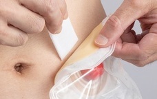 アルケア株式会社のプレスリリース画像2