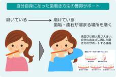 歯っぴー株式会社のプレスリリース画像1