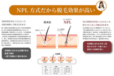 株式会社ラナルータのプレスリリース画像8