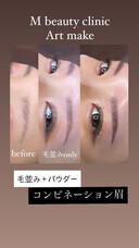 エムビューティークリニックのプレスリリース画像1