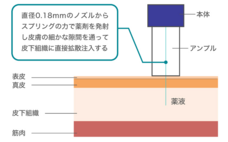 アイジェックス・ファーマインターナショナル株式会社のプレスリリース画像1