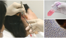 株式会社セルバンクのプレスリリース画像1