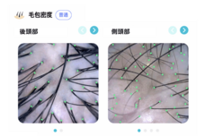 銀座総合美容クリニックのプレスリリース画像6