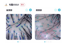 銀座総合美容クリニックのプレスリリース画像3