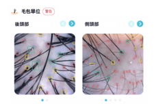 銀座総合美容クリニックのプレスリリース画像4