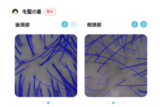 銀座総合美容クリニックのプレスリリース画像5