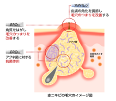 国立研究開発法人 国立国際医療研究センター AMR臨床リファレンスセンターのプレスリリース画像3