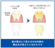 ホワイトエッセンス株式会社のプレスリリース画像7