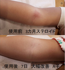 株式会社メディカルフロントのプレスリリース画像6