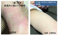 株式会社メディカルフロントのプレスリリース画像4